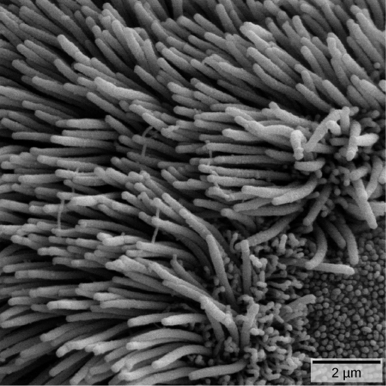 Figure 39.11. The bronchi and bronchioles contain cilia that help move mucus and other particles out of the lungs. (credit: Louisa Howard, modification of work by Dartmouth Electron Microscope Facility)