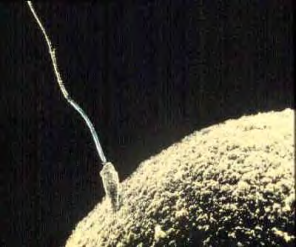 Sperm and ovum at conception.
