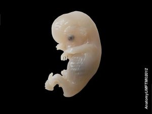 A human embryo.