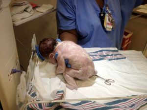 A newborn baby covered in vernix.