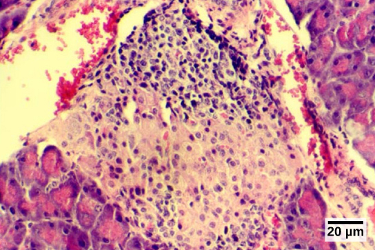 Figure 37.20. The islets of Langerhans are clusters of endocrine cells found in the pancreas; they stain lighter than surrounding cells. (credit: modification of work by Muhammad T. Tabiin, Christopher P. White, Grant Morahan, and Bernard E. Tuch; scale-bar data from Matt Russell)