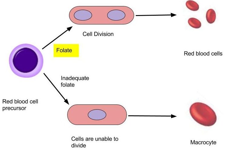 Folate and the Formation of Macrocytic Anemia