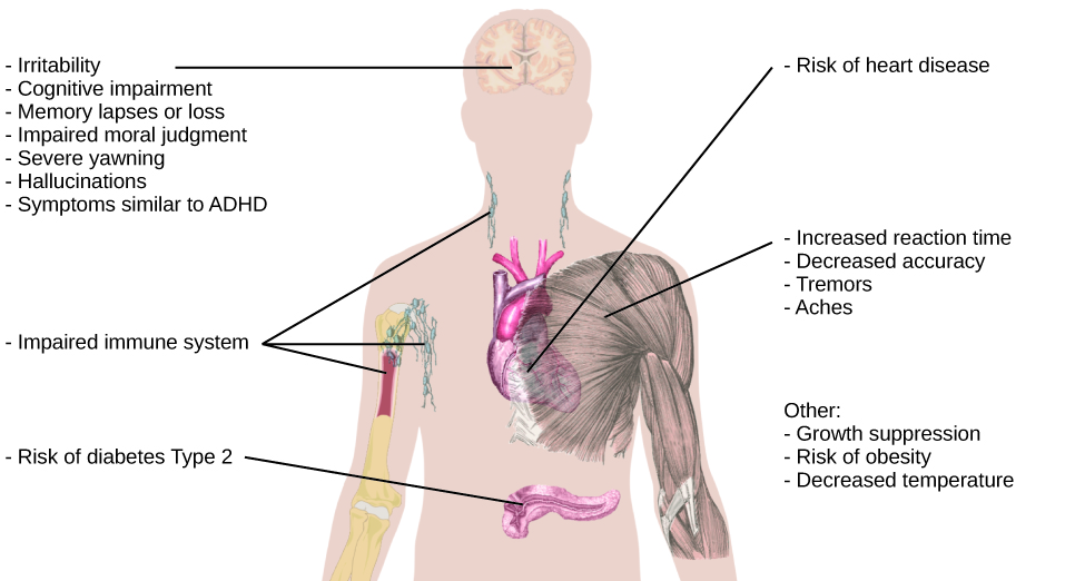 An illustration of the top half of a human body identifies the locations in the body that correspond with various adverse effects of sleep deprivation. The brain is labeled with “Irritability,” “Cognitive impairment,” “Memory lapses or loss,” “Impaired moral judgment,” “Severe yawning,” “Hallucinations,” and “Symptoms similar to ADHD.” The heart is labeled with “Risk of heart disease.” The muscles are labeled with “Increased reaction time,” “Decreased accuracy,” “Tremors,” and “Aches.” There is an organ near the stomach labeled “Risk of diabetes Type 2.” Various parts of the neck, arm, and underarm are labeled “Impaired immune system.” Other risks include “Growth suppression,” “Risk of obesity,” “Decreased temperature.”