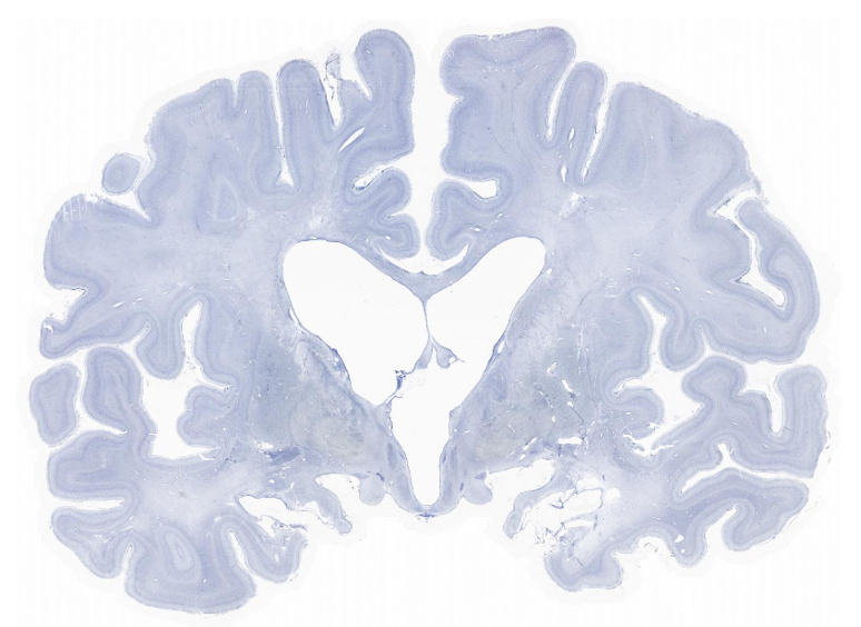 Coronal slice of brain with blue-stained colour