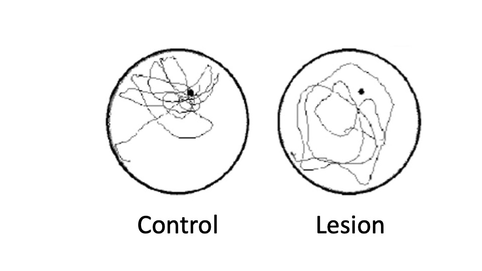 Two black circles, labelled as control (left-side) and lesion (right-side). Each circle contains a black dot reflecting the hidden platform location. The black line in each circle indicates the path a rat took while swimming in the water. In the control circle, the line is closely centred around the hidden platform. In the lesion circle, the black line is random and not centred around the black dot.