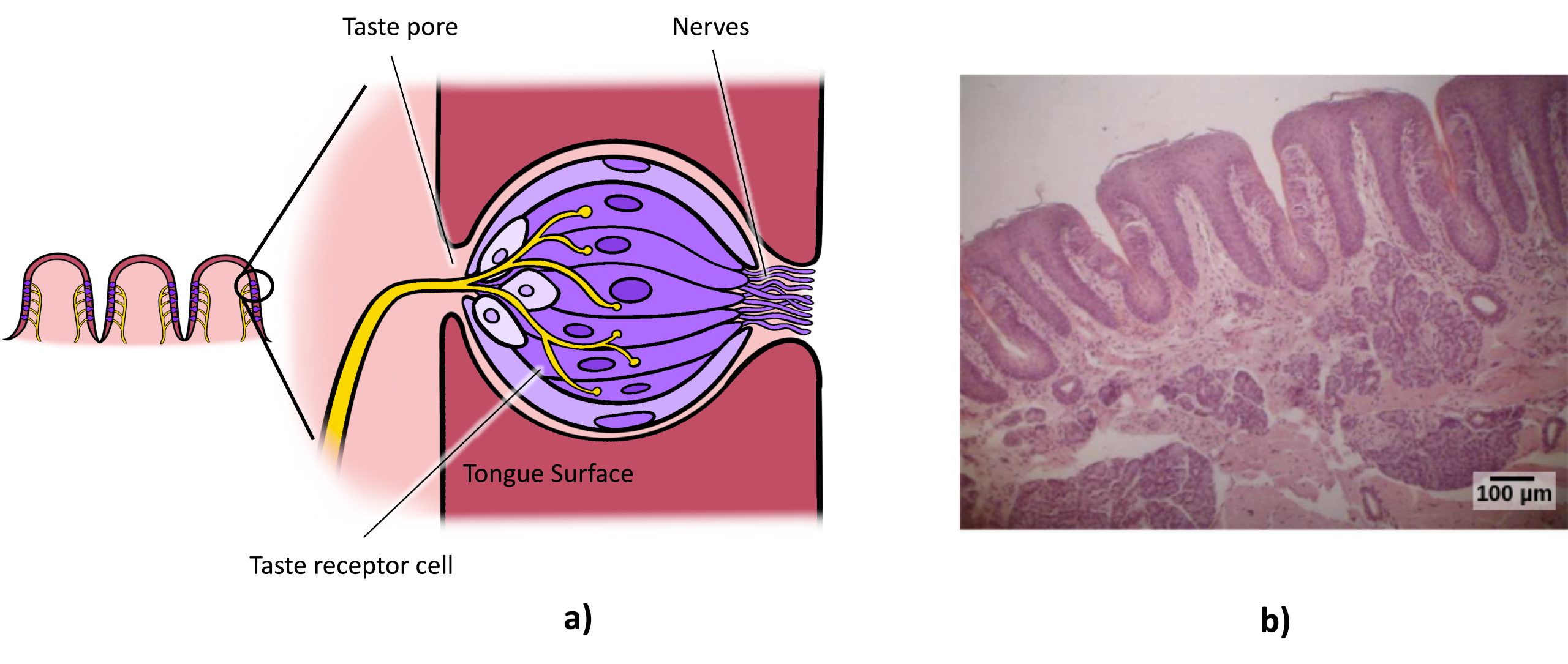 Illustration A shows a taste bud in an opening of the tongue, with the “tongue surface,” “taste pore,” “taste receptor cell” and “nerves” labeled. Part B is a micrograph showing taste buds on a human tongue.